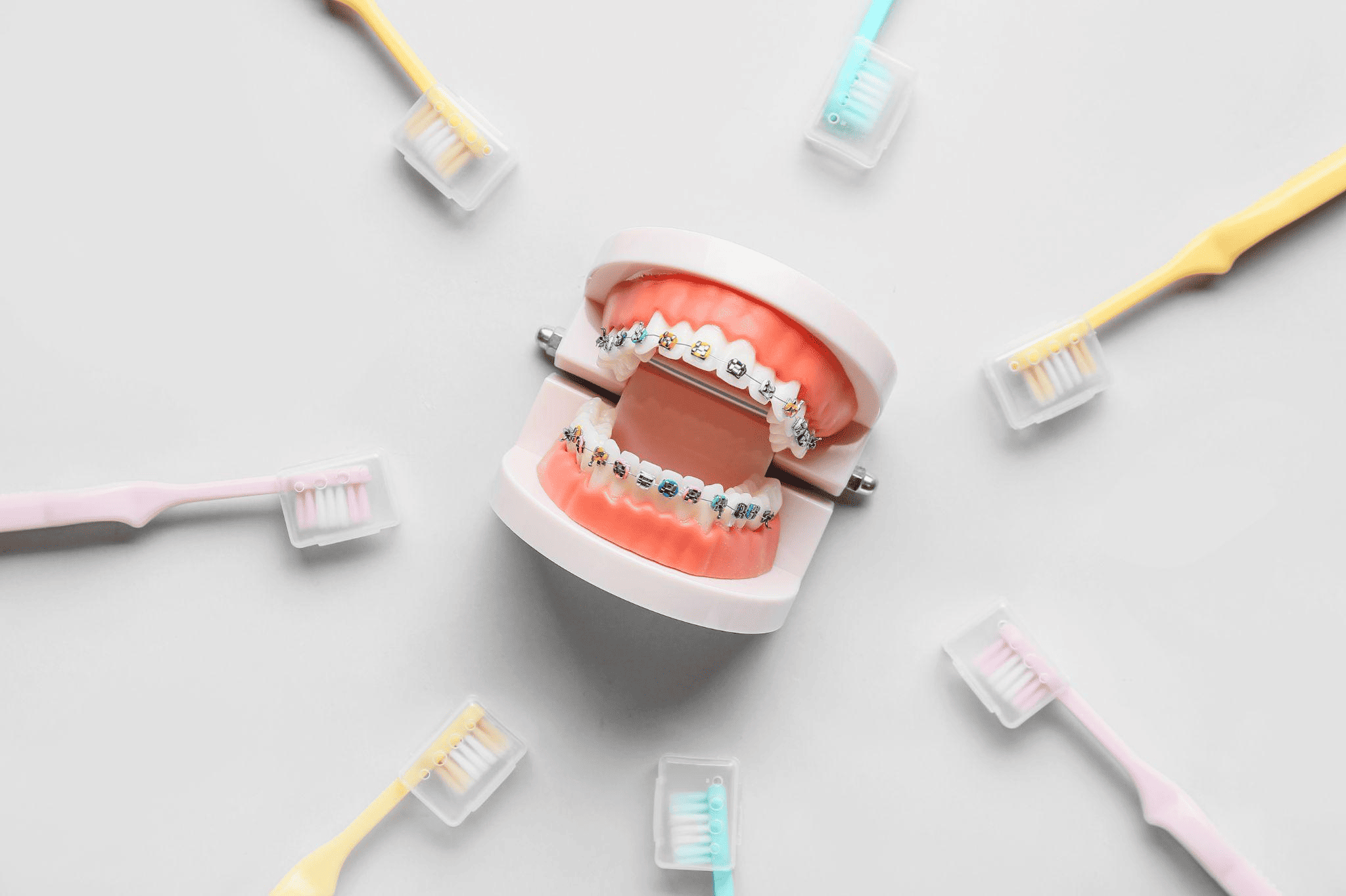 歯科矯正で医療費控除を受けられる条件