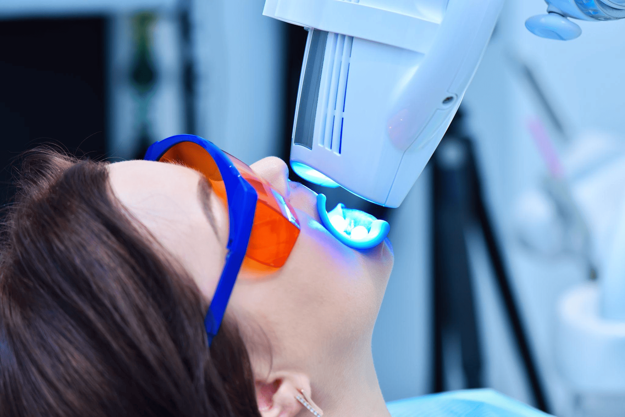 ホワイトニングのメリット・デメリット