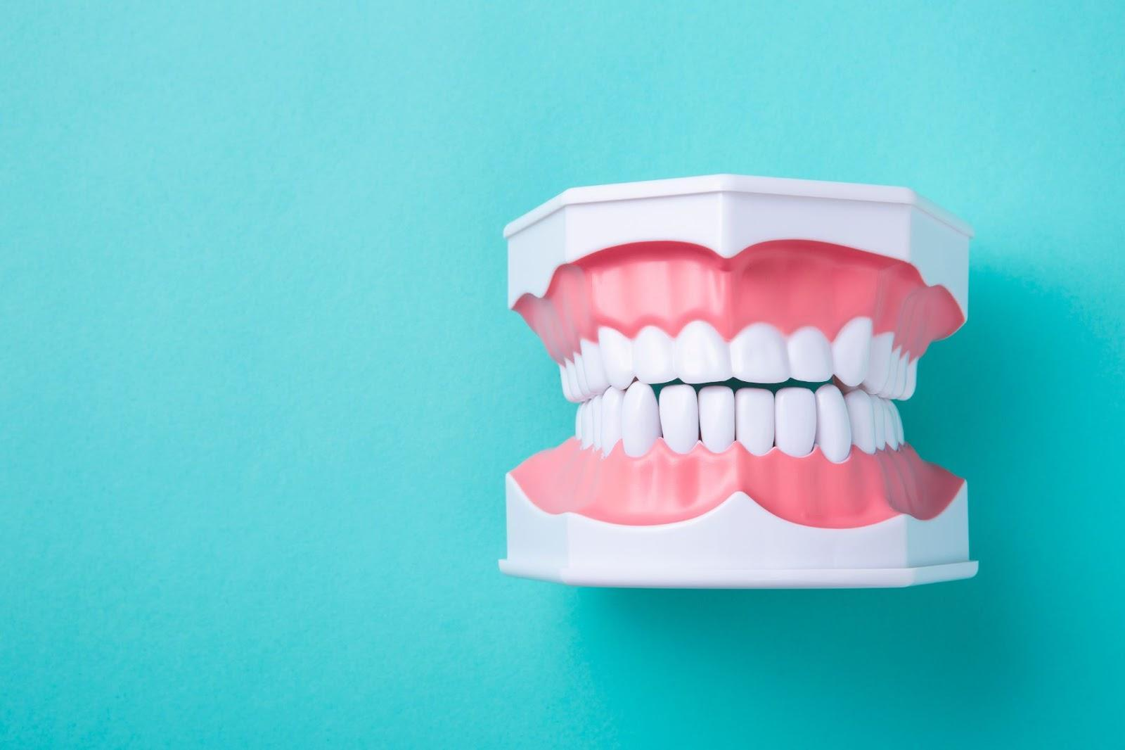 ダイレクトボンディングの寿命を左右する要素