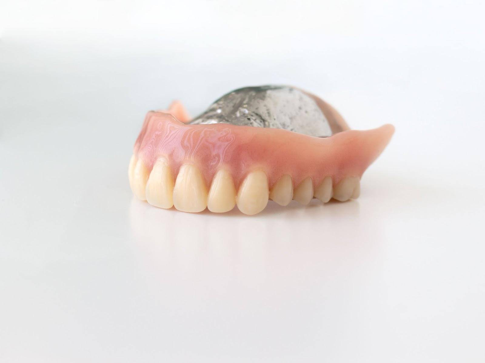 金属床義歯のデメリットは？メリットや主な種類についても解説