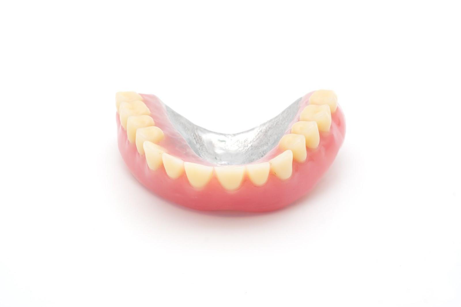 金属床義歯の種類